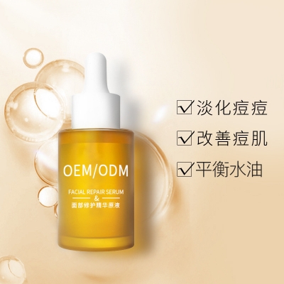 黑河市_祛痘精华原液OEM